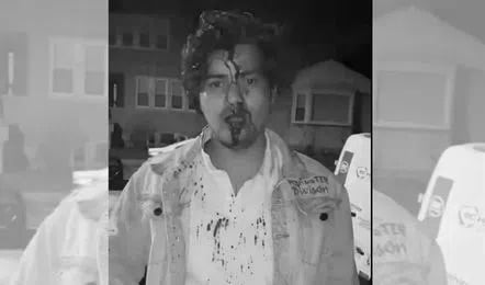 Syed Mazahir Ali Attacked